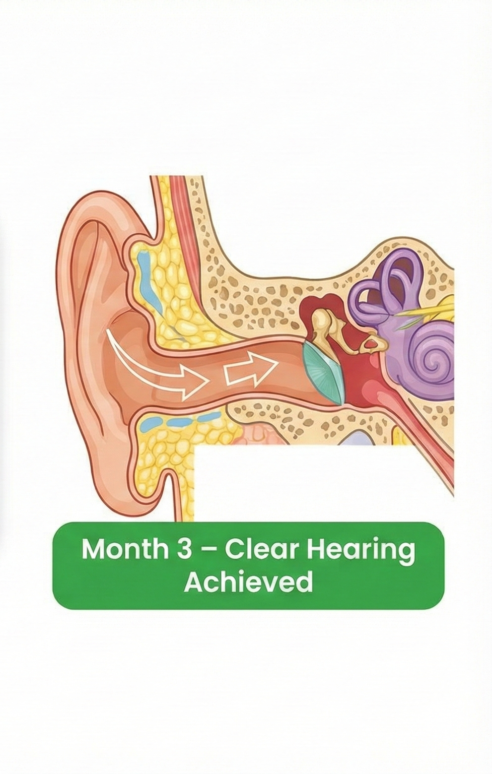 Audizen progress result 3